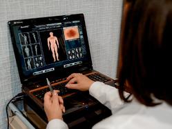 Dermatoscopia computerizată- diagnоsticul și monitorizarea alunițelor