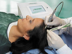 Implantul de păr cu Biofibre